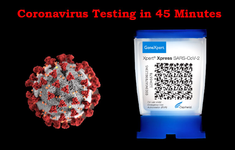 FDA approves a new test for Coronavirus that gives results in just 45 minutes, But only for hospital’s emergency room.